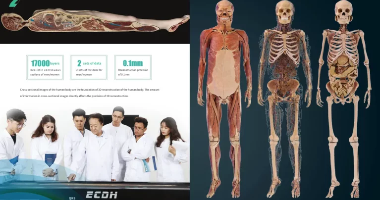 DIGIHUMAN HD Virtual Anatomy Table