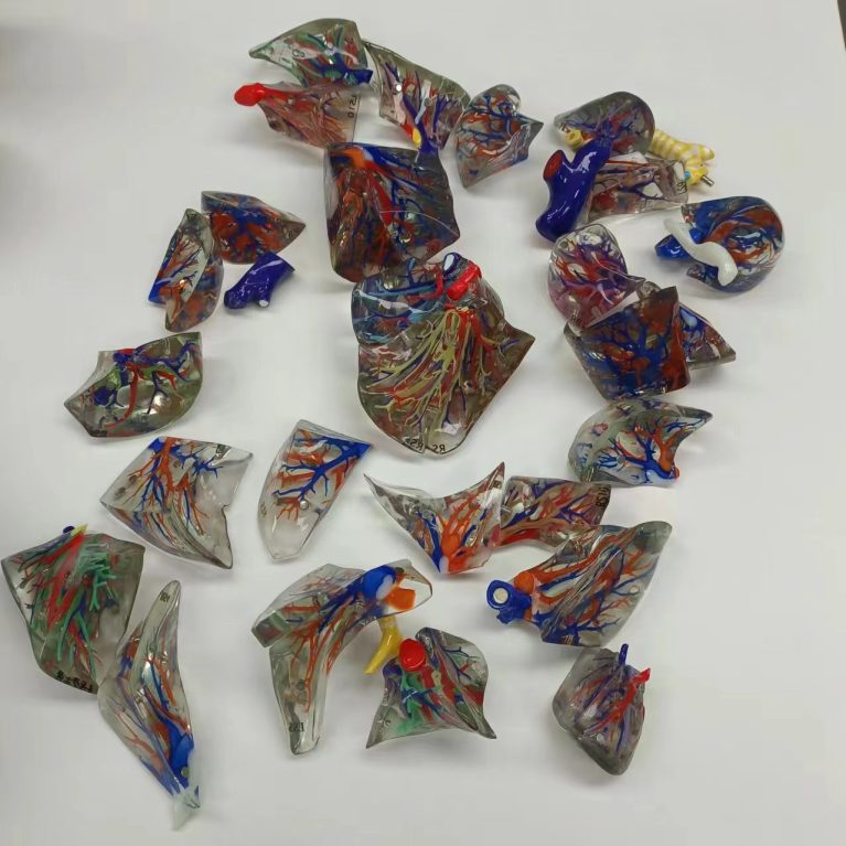 3D lung model