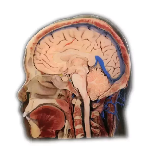 3d printed head model